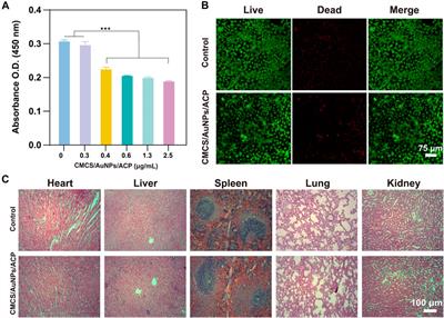Carboxymethyl chitosan stabilized AuNPs/ACP nanohybrids in enamel white spot lesions